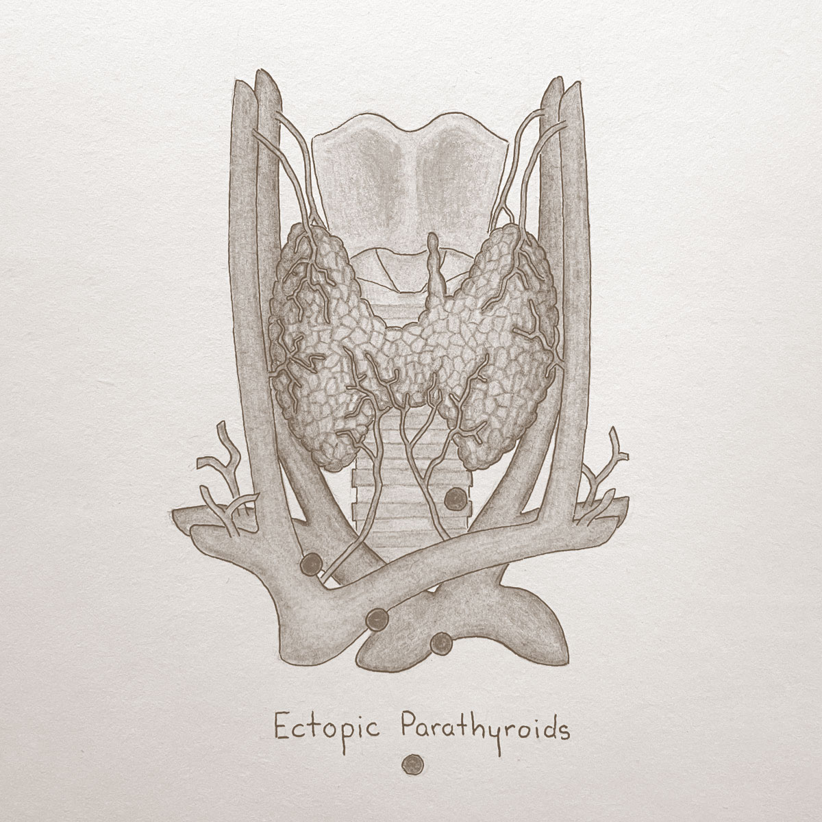 Sepia anatomical illustration showing location of ectopic parathyroids